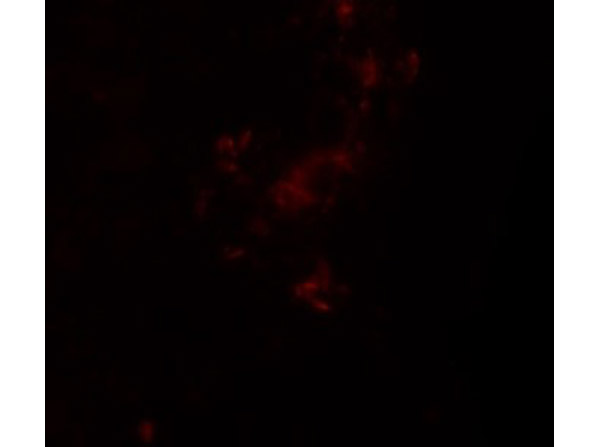 Immunofluorescence of ZBTB5