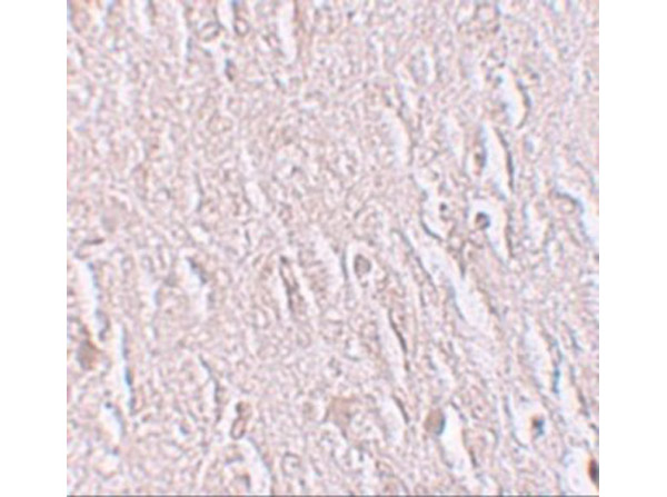 Immunohistochemistry of ZBTB5