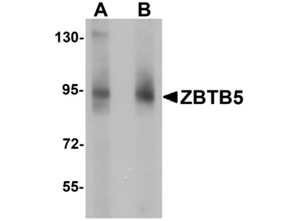 Western blot analysis of ZBTB5