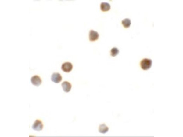 Immunocytochemistry of ZBTB6