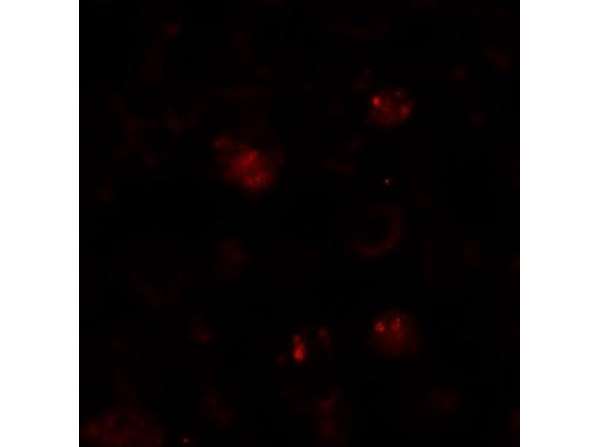 Immunofluorescence of ZBTB6