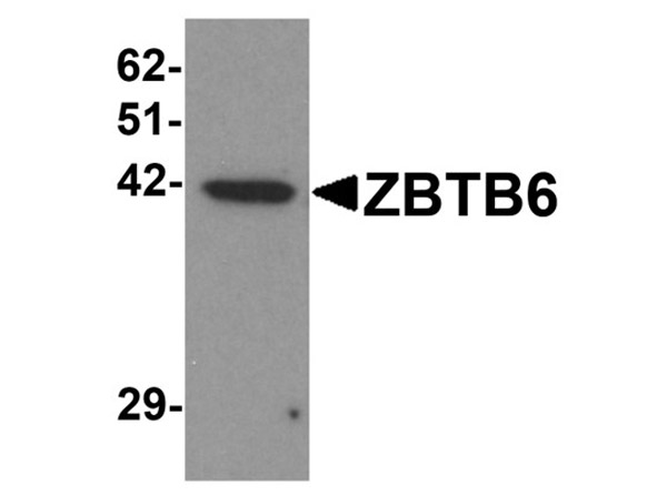 Western blot analysis of ZBTB6