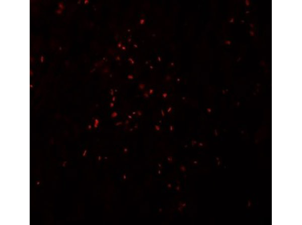 Immunofluorescence of ZBTB7A