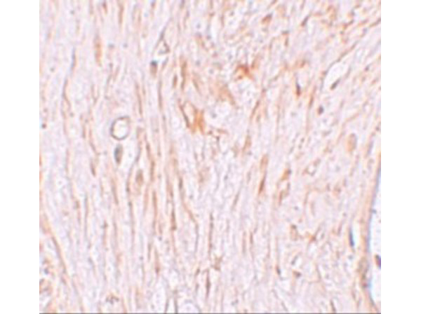 Immunohistochemistry of ZBTB7A