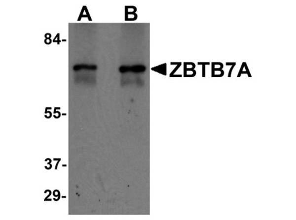 Western blot analysis of ZBTB7A