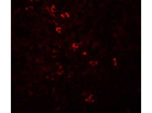 Immunofluorescence of ZBTB8