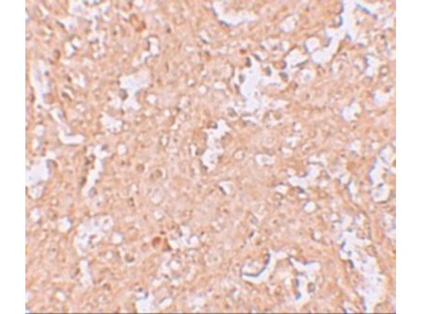 Immunohistochemistry of ZBTB8