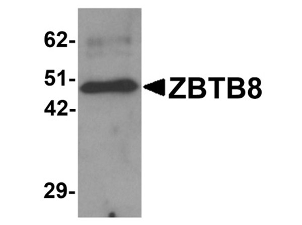 Western blot analysis of ZBTB8