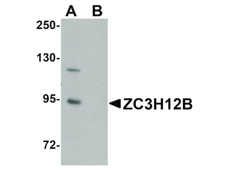 Western Blot of ZC3H12B Antibody