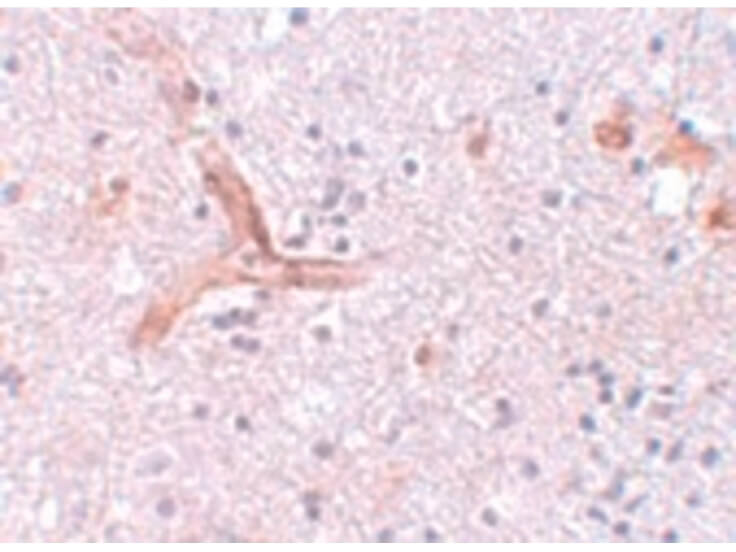 Immunohistochemistry of ZC3H12C Antibody