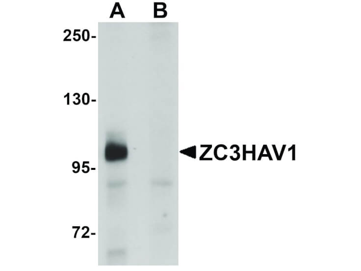 Western Blot of ZC3HAV1 Antibody