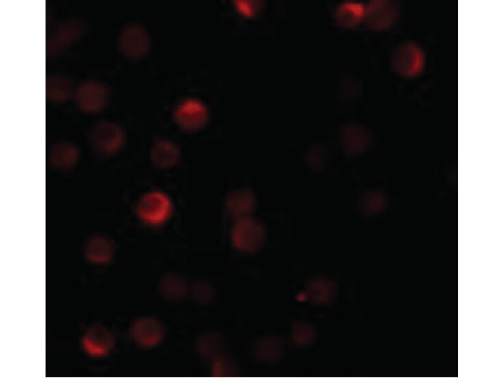 Immunofluorescence of ZC3HAV1 Antibody