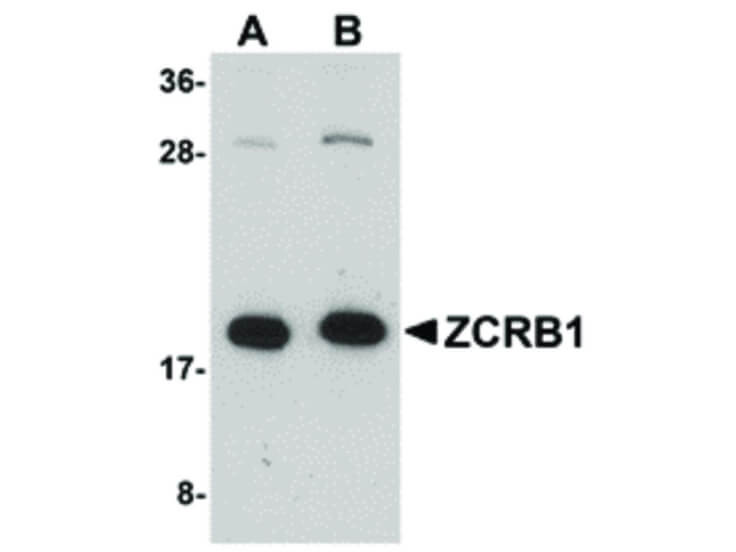 Western Blot of ZCRB1 Antibody