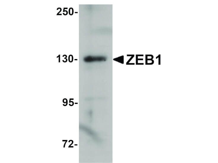 Western Blot of ZEB1 Antibody