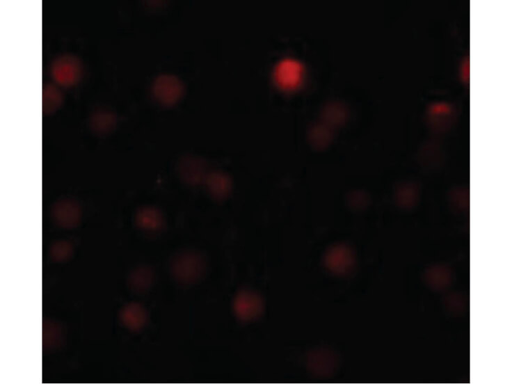 Immunofluorescence of ZEB1 Antibody