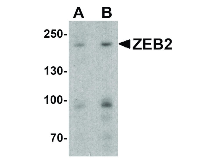 Western Blot of ZEB2 Antibody