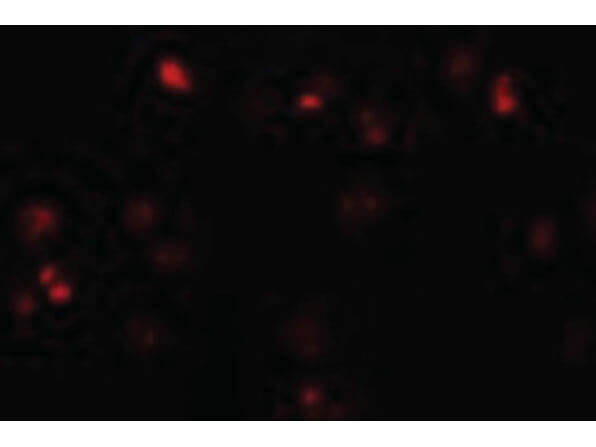 Immunofluorescence of ZEB2 Antibody