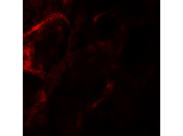 Immunofluorescence of ZF21