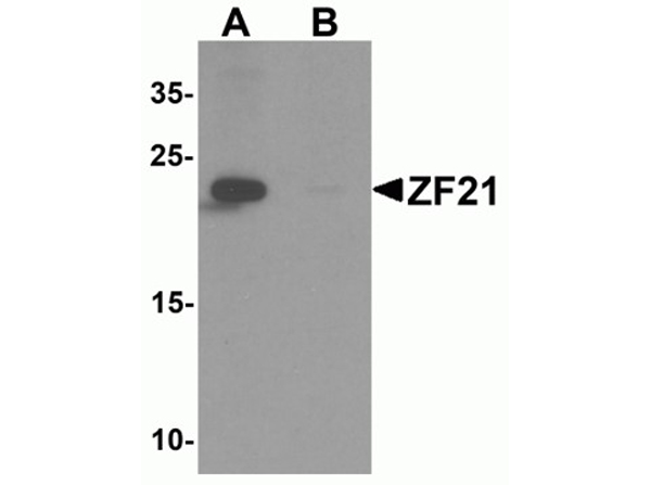 Western blot analysis of ZF21
