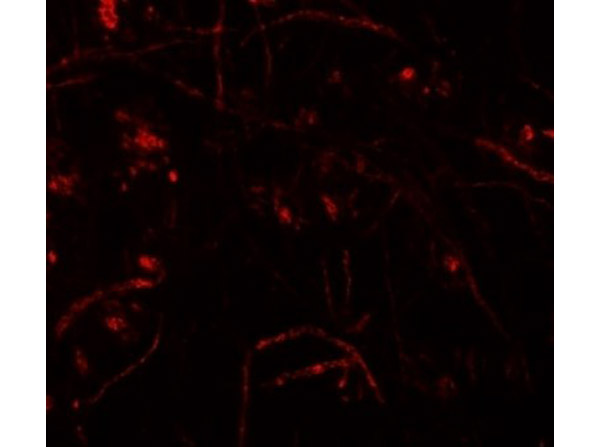 Immunofluorescence of ZFP219