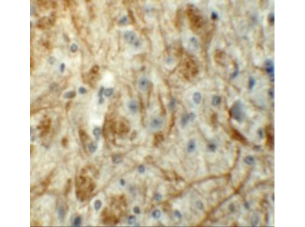 Immunohistochemistry of ZFP219