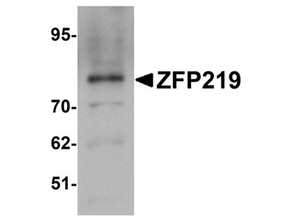 Western blot analysis of ZFP219