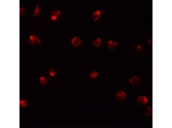 Immunofluorescence of ZFP281