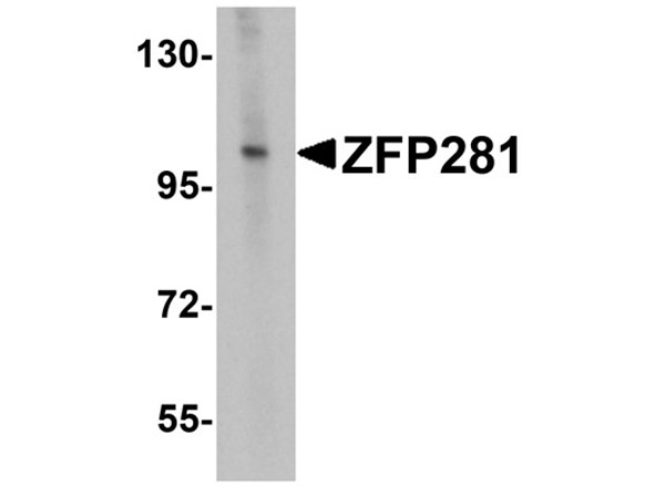 Western blot analysis of ZFP281