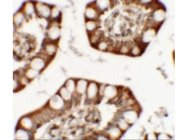 Immunohistochemistry of ZFX