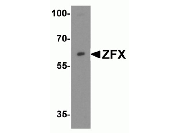 Western blot analysis of ZFX