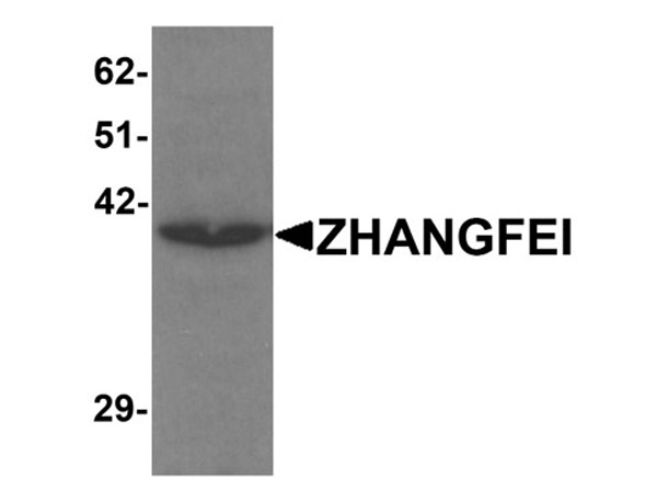 Western blot analysis of ZHANGFEI