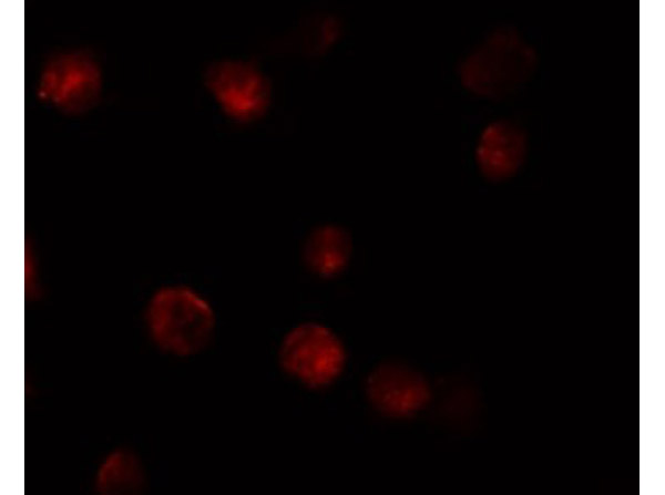 Immunofluorescence of ZIMP10