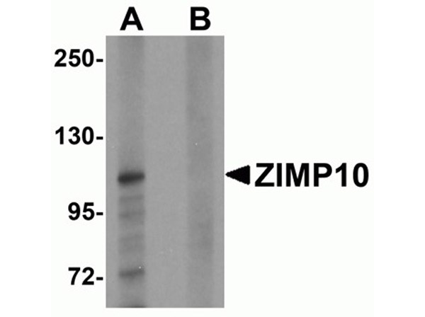 Western blot analysis of ZIMP10