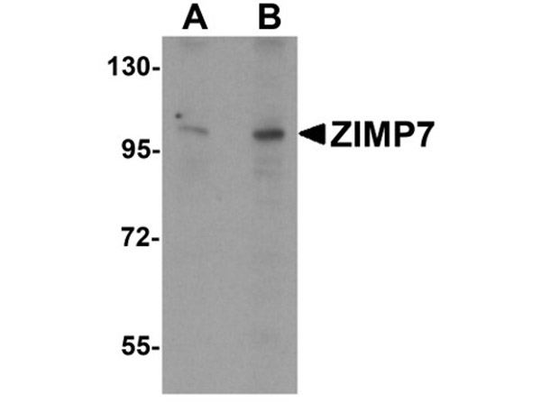 Western blot analysis of ZIMP7