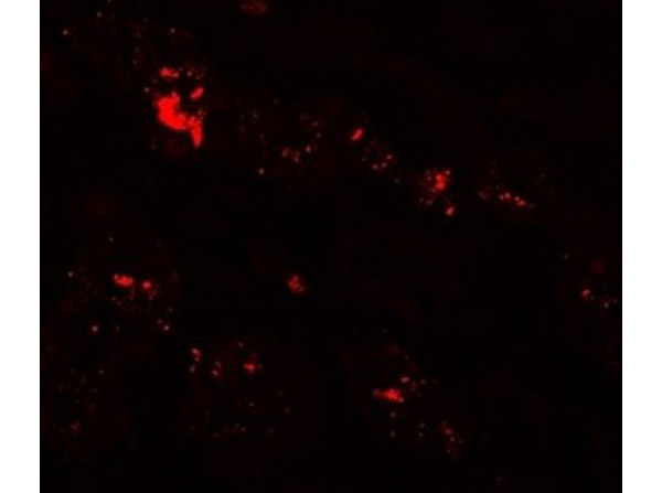 Immunofluorescence of ZIP1