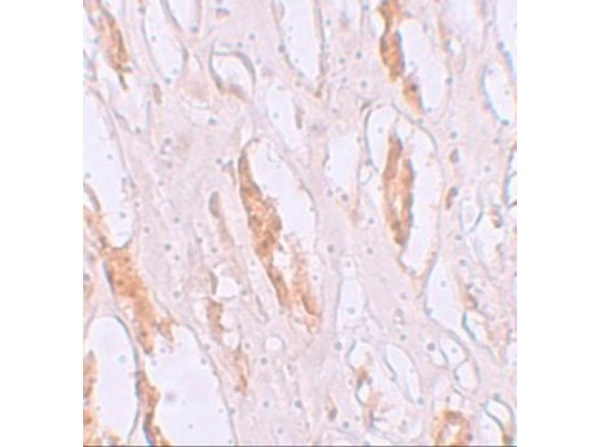 Immunohistochemistry of ZIP1