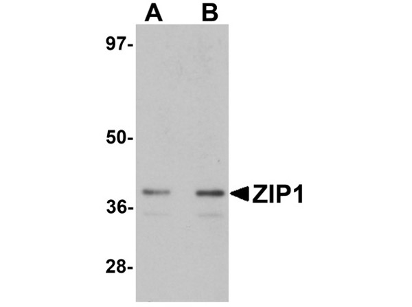 Western blot of ZIP1