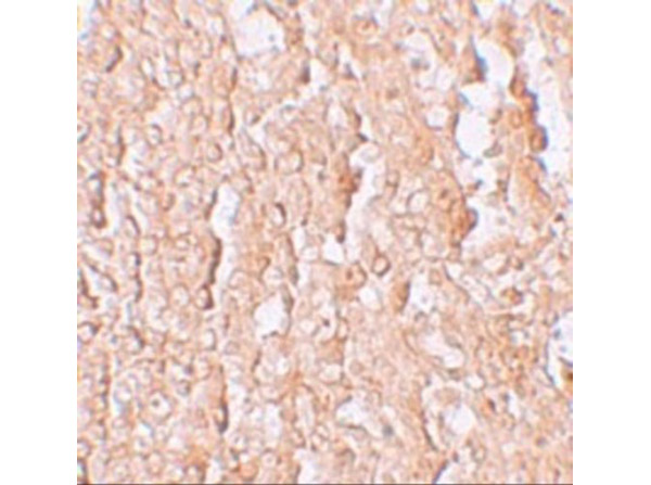 Immunohistochemistry of ZIP10