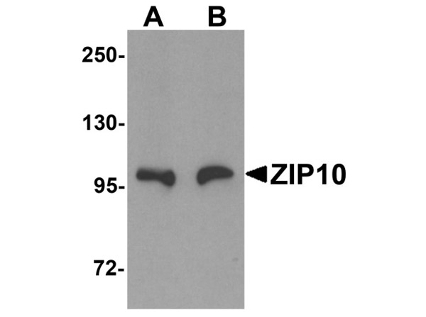 Western blot analysis of ZIP10