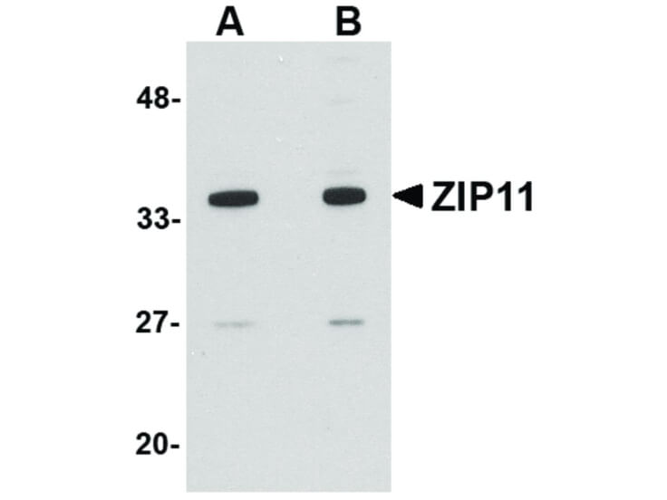Western Blot of ZIP11 Antibody