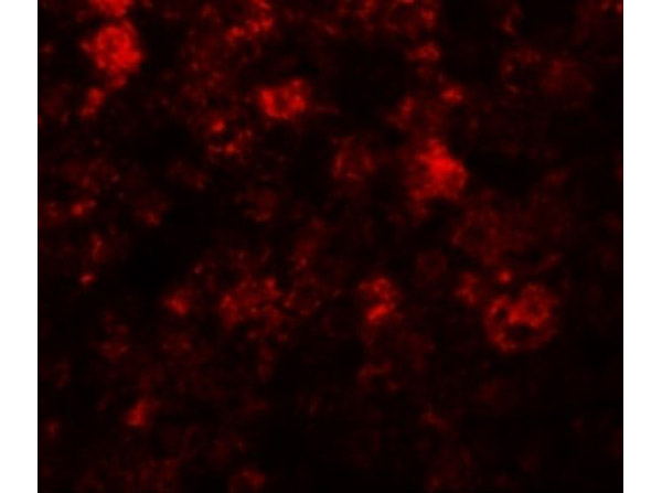 Immunofluorescence of ZIP12