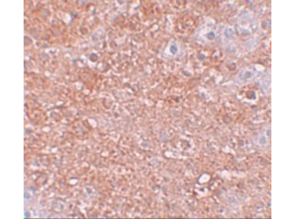 Immunohistochemistry of ZIP12