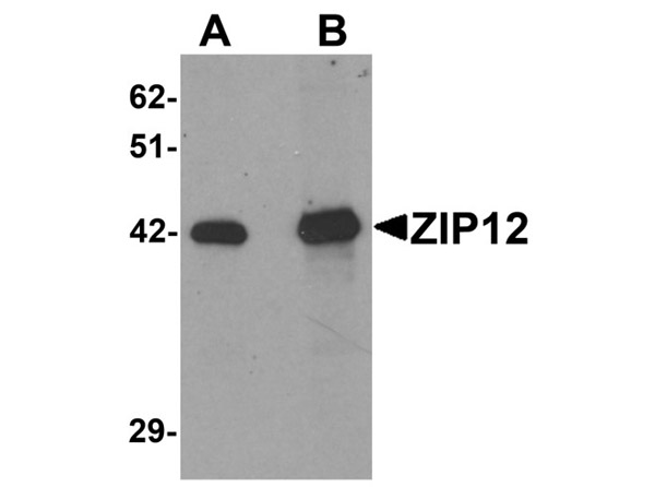 Western blot analysis of ZIP12