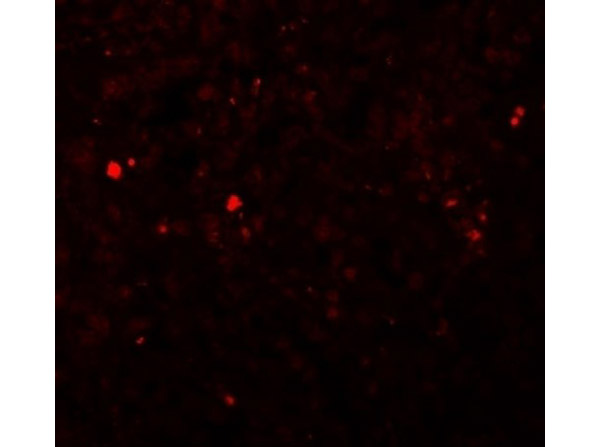 Immunofluorescence of ZIP13