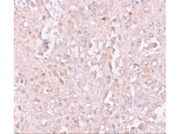 Immunohistochemistry of ZIP13