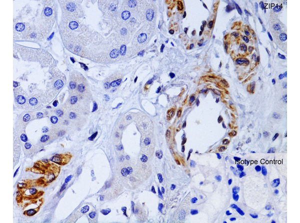 Immunohistochemistry Validation of ZIP14