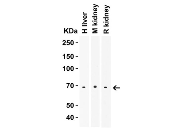 Western blot of ZIP14