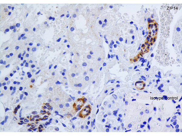 Immunohistochemistry Validation of ZIP14