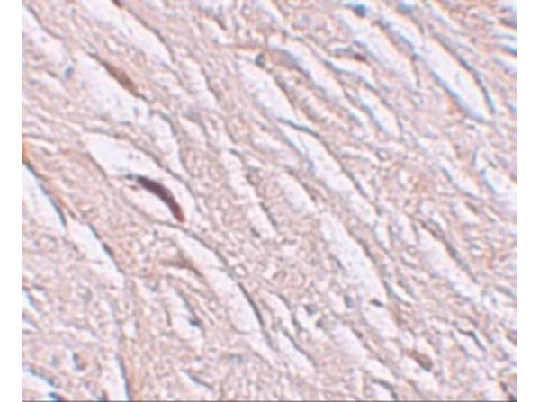 Immunohistochemistry of ZIP2