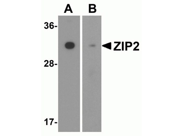 Western blot of ZIP2